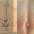 Företag 3 bild BROMMA ESTETIK i Vällingby AB