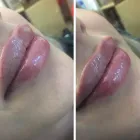 Företag 2 bild LASER KLINIK BEAUTY - SKÖNHETSKLINIK VASASTAN i Stockholm