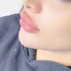 Företag 3 bild LASER KLINIK BEAUTY - SKÖNHETSKLINIK VASASTAN i Stockholm