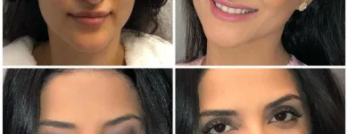 Företag 26 bild ZEINA'S BEAUTY CENTER - SKÖNHETSSALONG SOLNA i Solna AB